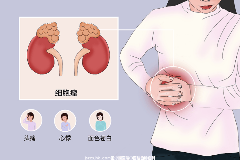 广州中医药大学金沙洲肿瘤医院孙倩倩医生：肾脏从健康到癌变，细胞的“叛变”之路
