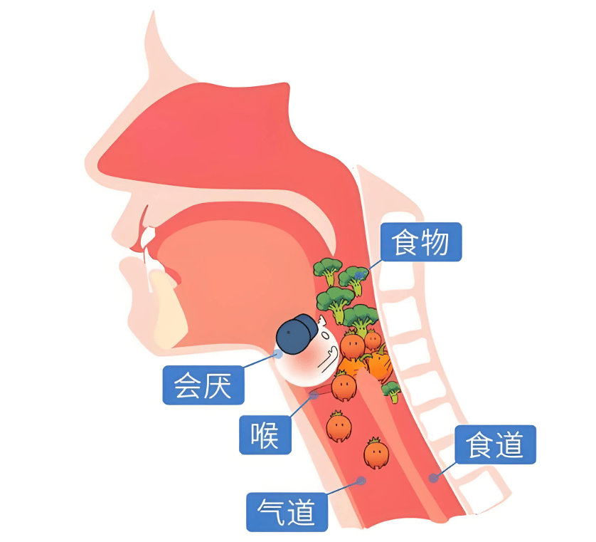 警惕！食道肿瘤的6个明显信号，出现1个就该及时排查
